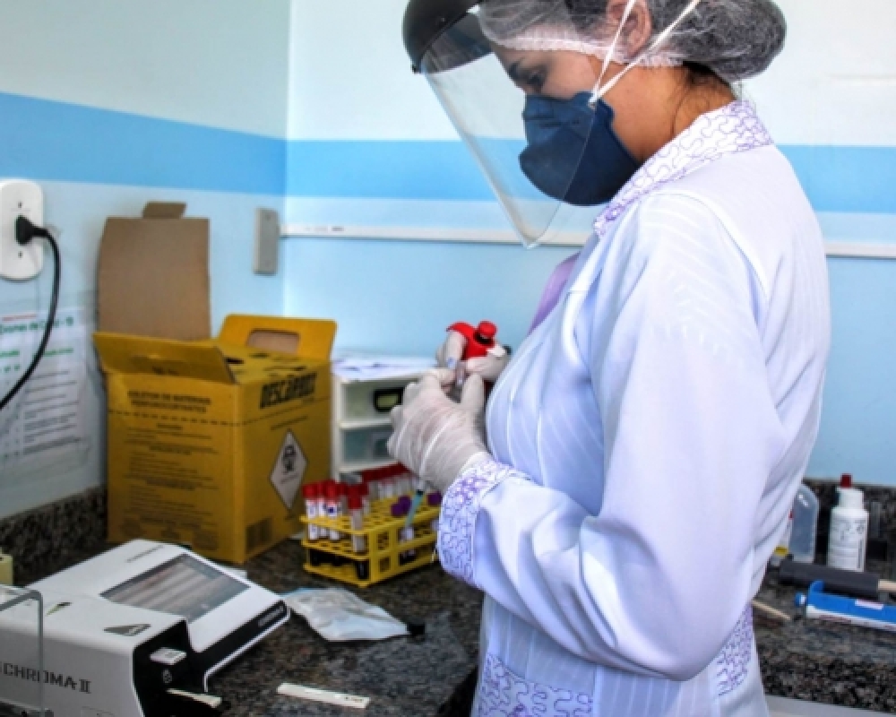 Pacientes contam com testes rápidos e exame de sorologia para diagnóstico de Covid19 em Campo Alegre