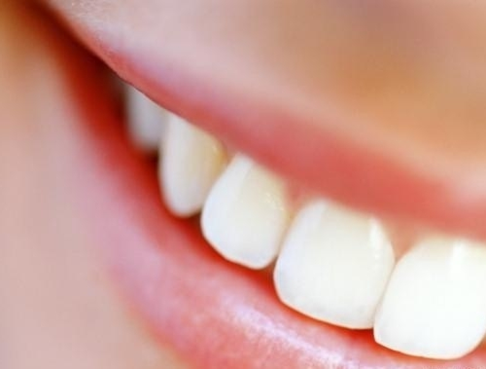 Secretaria de Saúde passou a oferecer prótese dentária gratuita em Campo Alegre